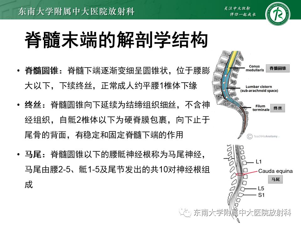 【PPT】脊髓拴系综合征-6
