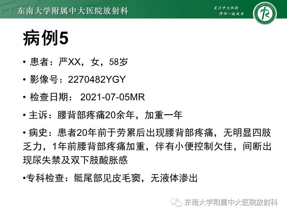 【PPT】脊髓拴系综合征-25