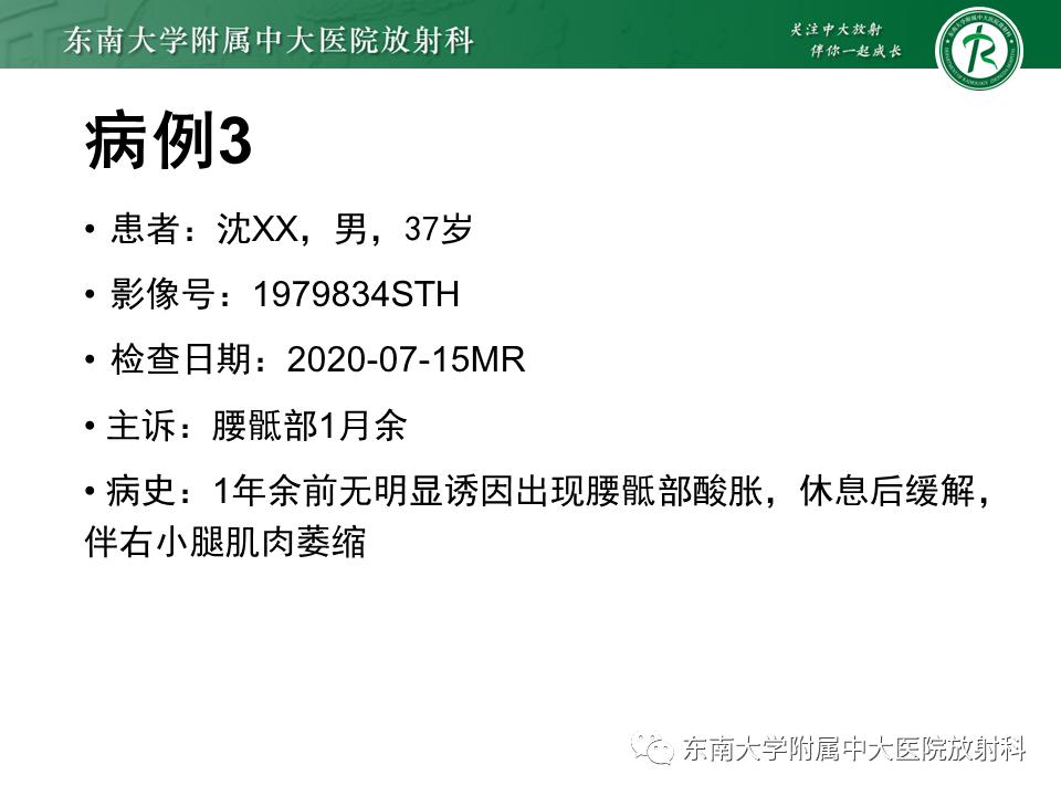 【PPT】脊髓拴系综合征-19