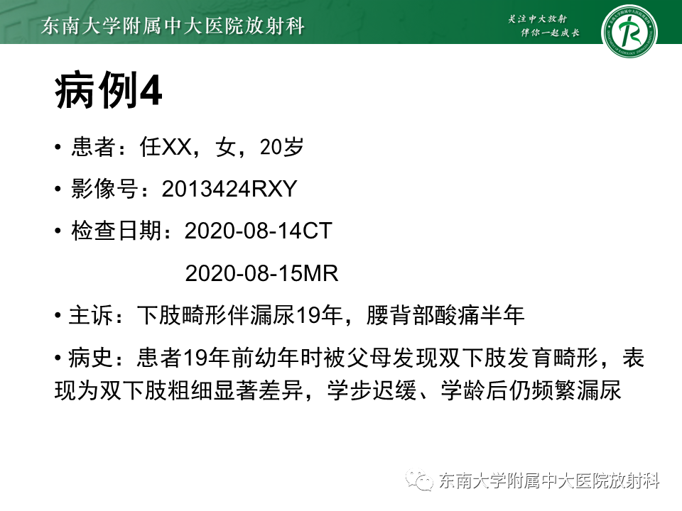 【PPT】脊髓拴系综合征-22