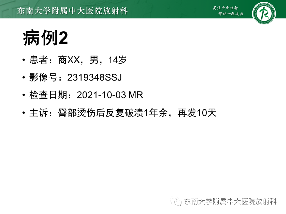 【PPT】脊髓拴系综合征-16