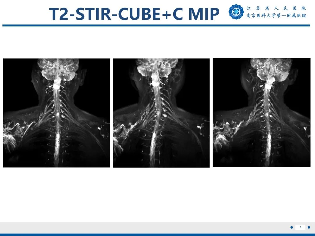 【PPT】臂丛病变-7