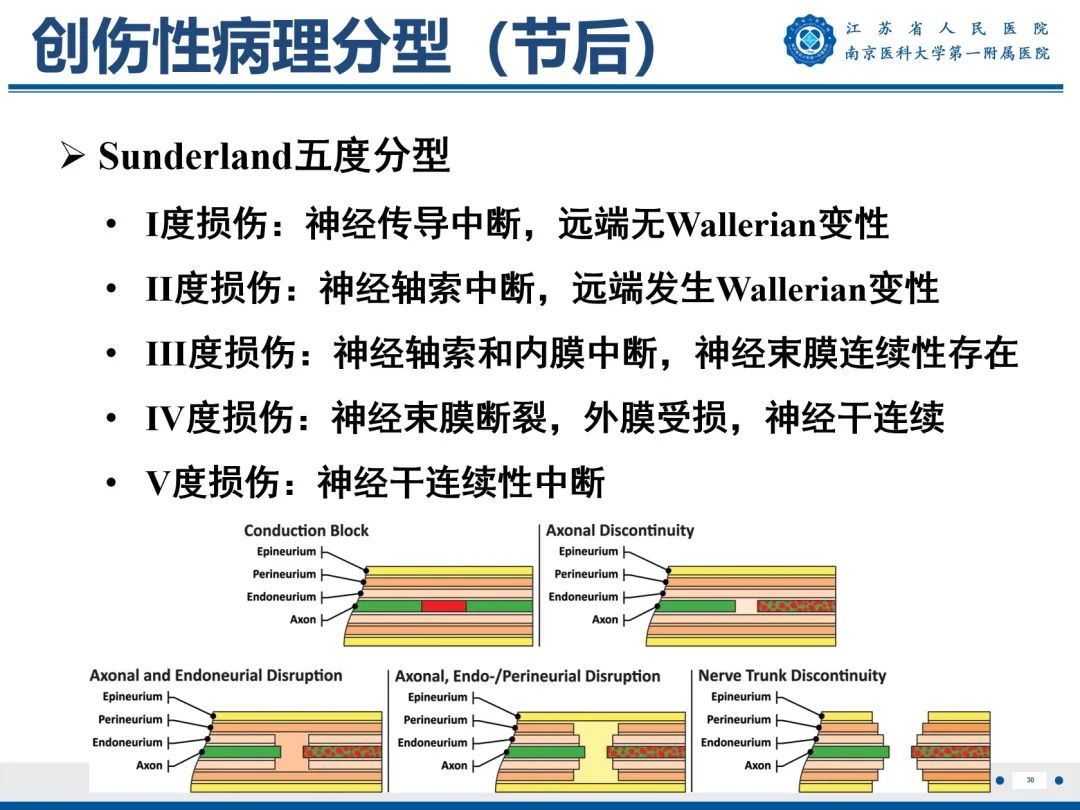【PPT】臂丛病变-31