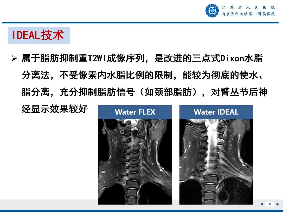【PPT】臂丛病变-25