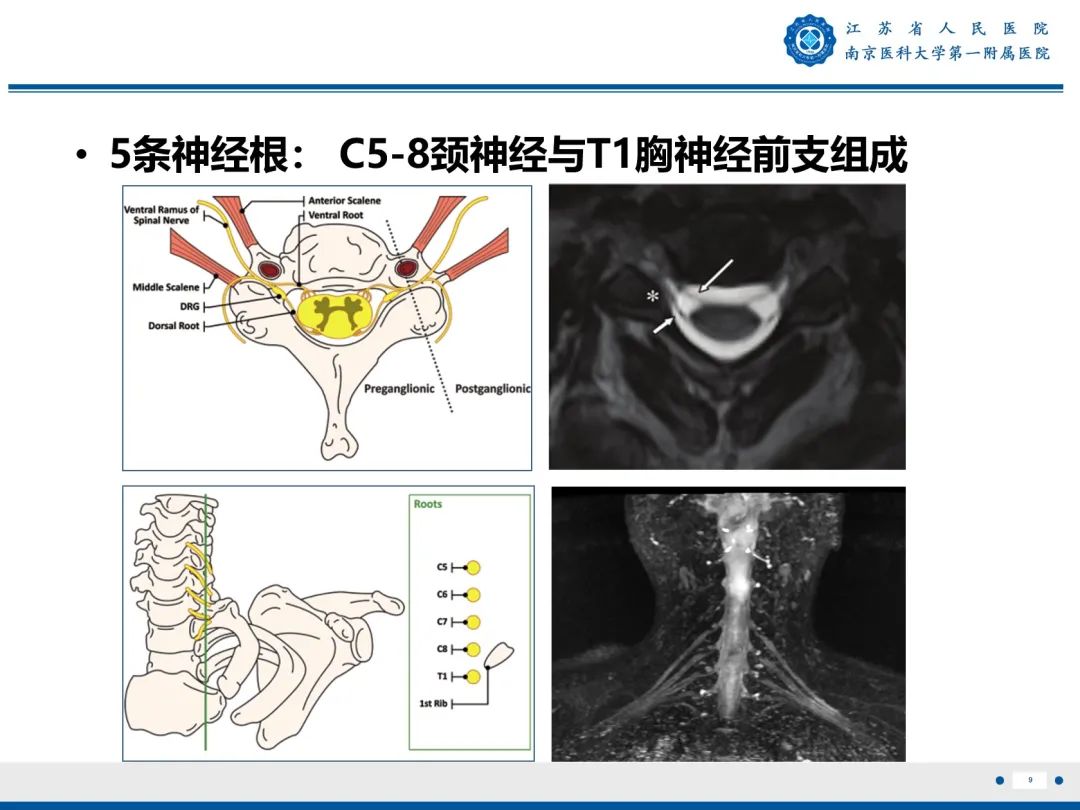 【PPT】臂丛病变-10