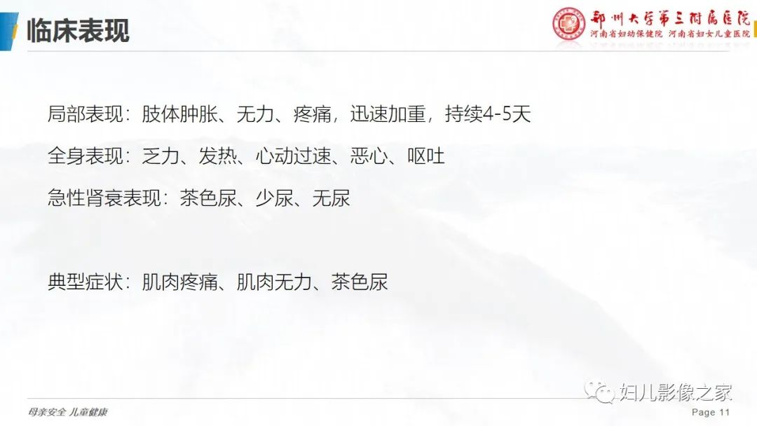 【病例】横纹肌溶解症1例MR影像-11