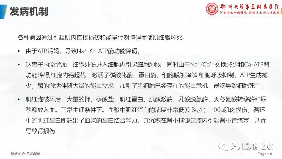 【病例】横纹肌溶解症1例MR影像-10