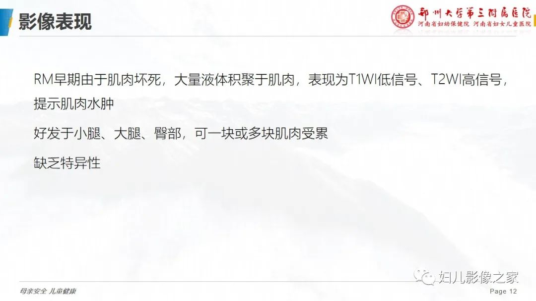 【病例】横纹肌溶解症1例MR影像-12