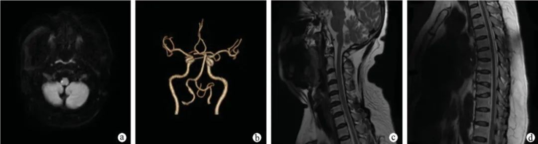 【病例】肢体麻木，定位可千万别漏掉这个地方-10