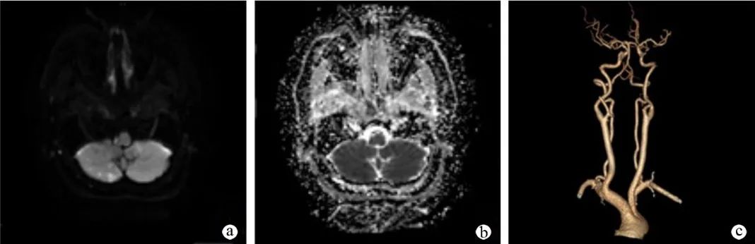 【病例】肢体麻木，定位可千万别漏掉这个地方-11