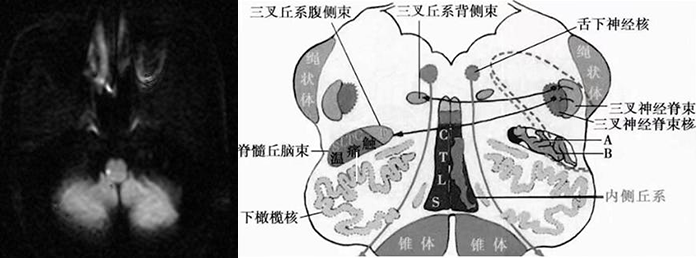 【病例】肢体麻木，定位可千万别漏掉这个地方-7
