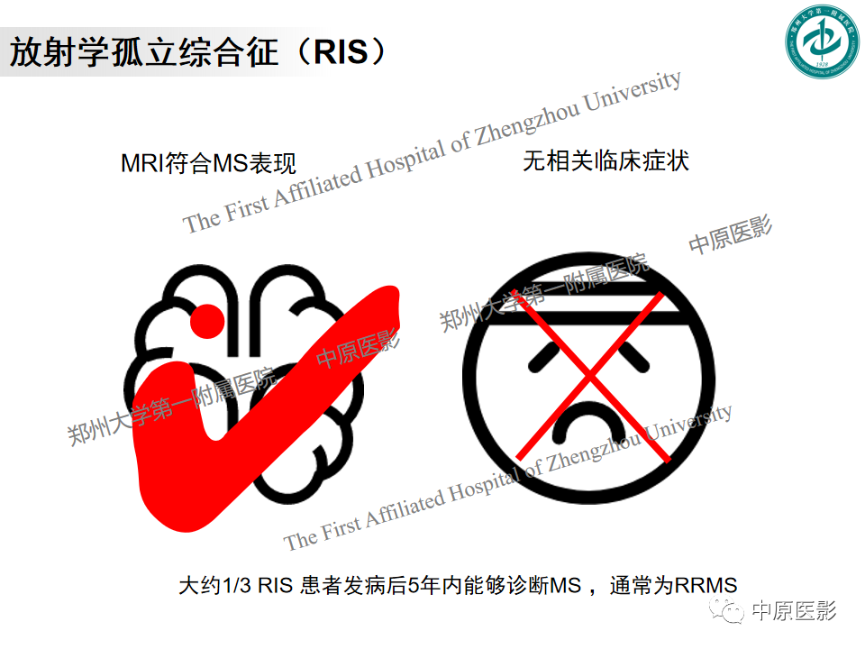 【PPT】视神经脊髓炎与多发性硬化鉴别诊断-25