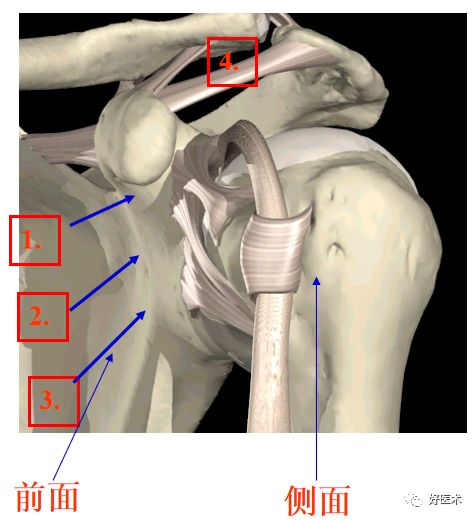 肩关节损伤的影像学诊断-3