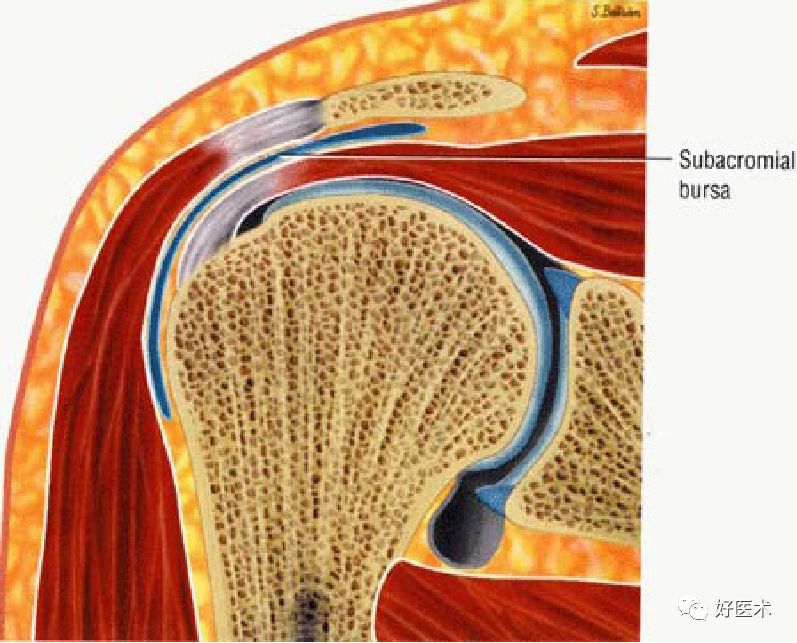 肩关节损伤的影像学诊断-19