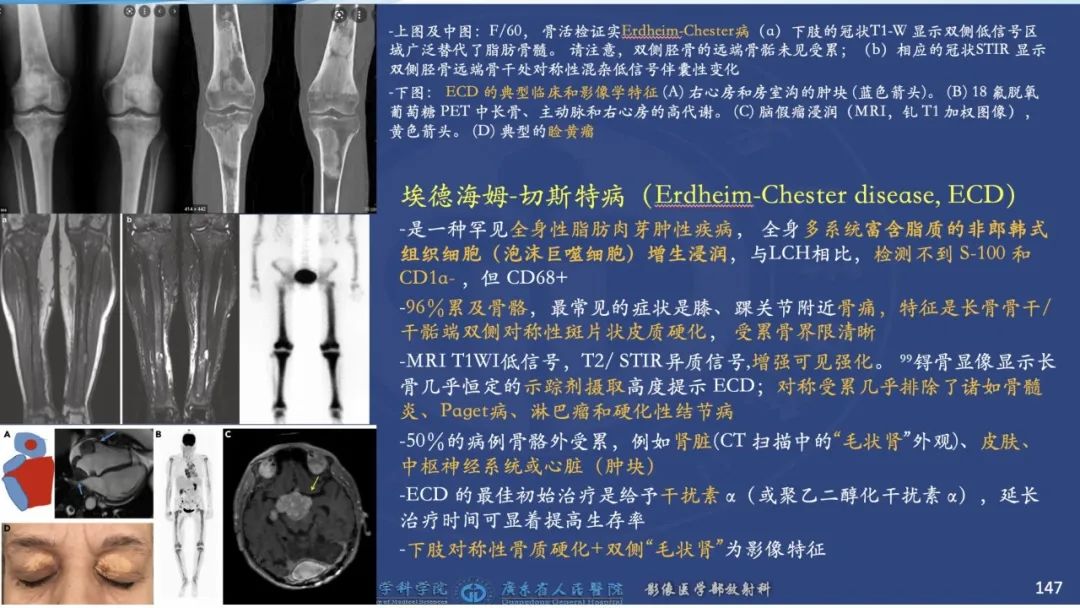 【病例】一例表现为弥漫中轴骨骨质增生硬化病变讨论-40