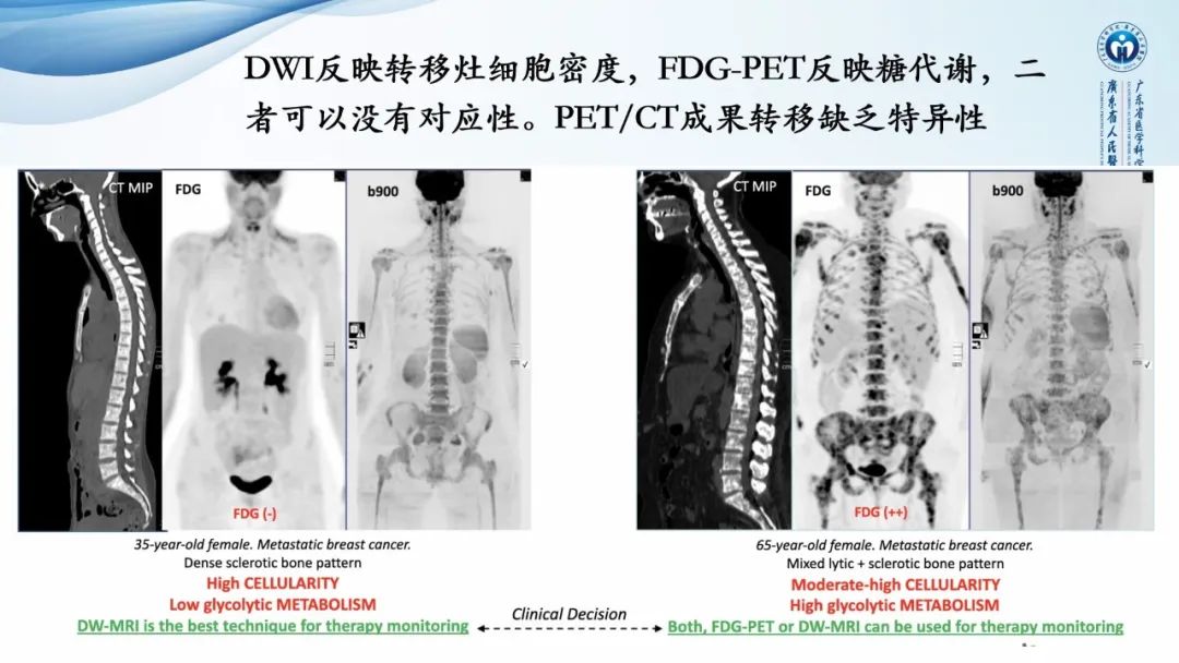 【病例】一例表现为弥漫中轴骨骨质增生硬化病变讨论-24