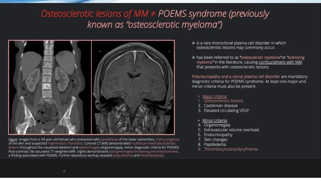 【病例】一例表现为弥漫中轴骨骨质增生硬化病变讨论-43