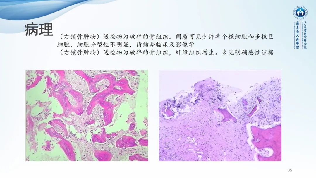 【病例】一例表现为弥漫中轴骨骨质增生硬化病变讨论-35