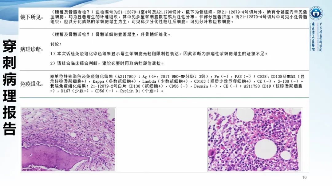 【病例】一例表现为弥漫中轴骨骨质增生硬化病变讨论-16