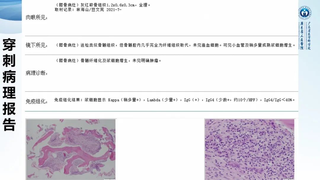 【病例】一例表现为弥漫中轴骨骨质增生硬化病变讨论-15