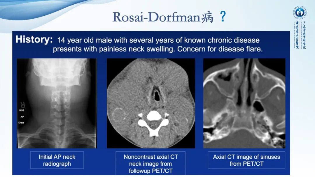 【病例】一例表现为弥漫中轴骨骨质增生硬化病变讨论-26