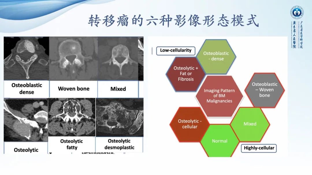 【病例】一例表现为弥漫中轴骨骨质增生硬化病变讨论-21