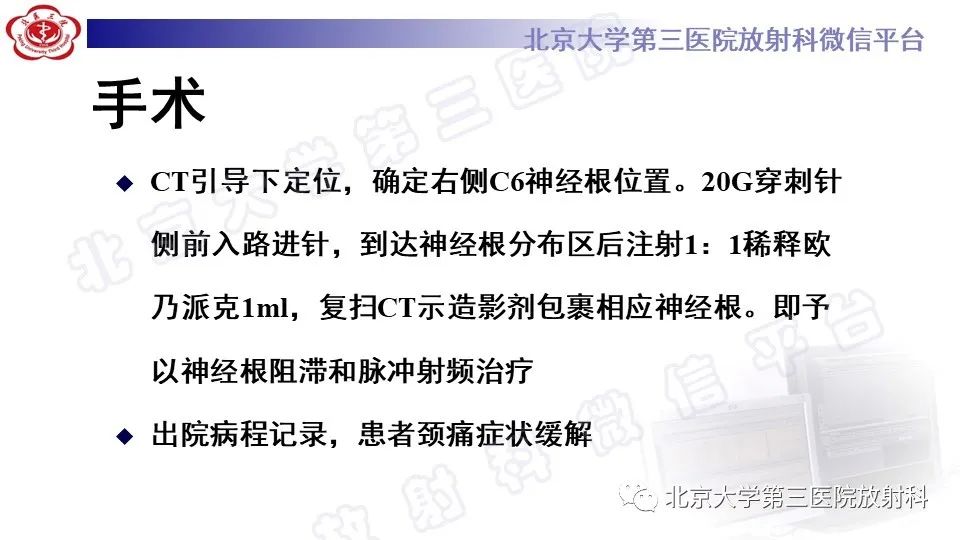【PPT】CT引导下介入技术在脊柱退行性疾病诊疗中的应用-7