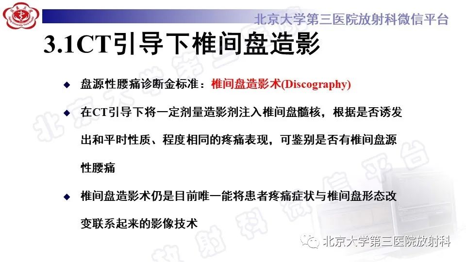 【PPT】CT引导下介入技术在脊柱退行性疾病诊疗中的应用-24