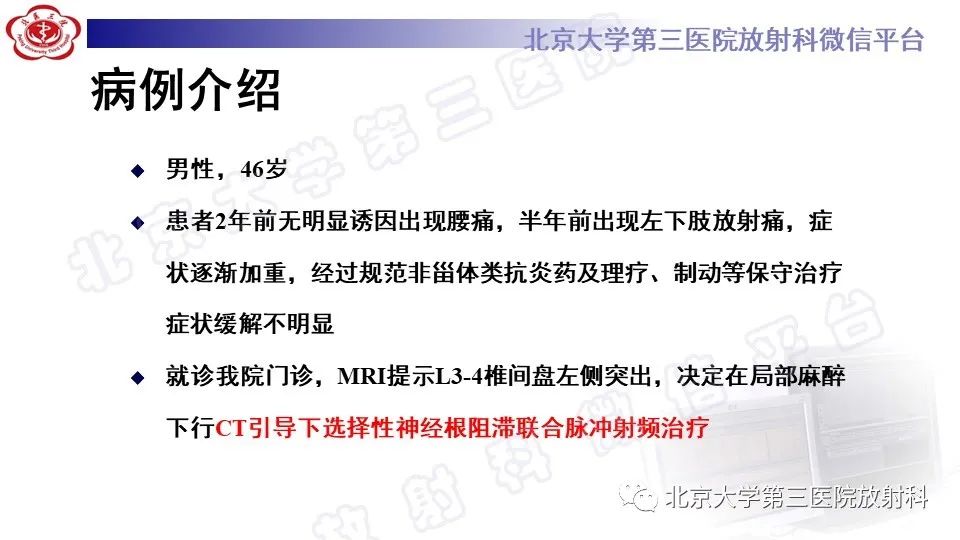 【PPT】CT引导下介入技术在脊柱退行性疾病诊疗中的应用-9