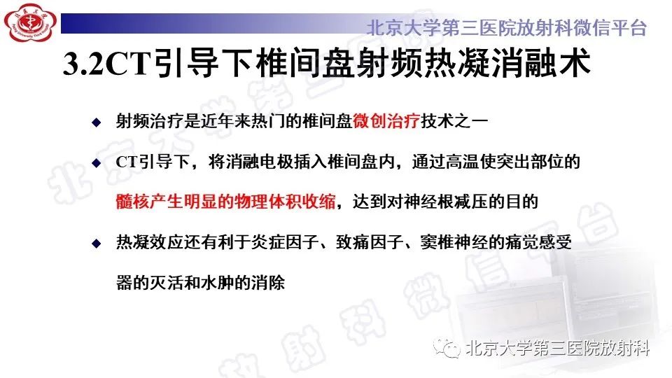 【PPT】CT引导下介入技术在脊柱退行性疾病诊疗中的应用-25
