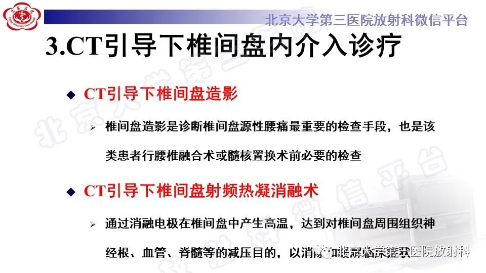 【PPT】CT引导下介入技术在脊柱退行性疾病诊疗中的应用-22
