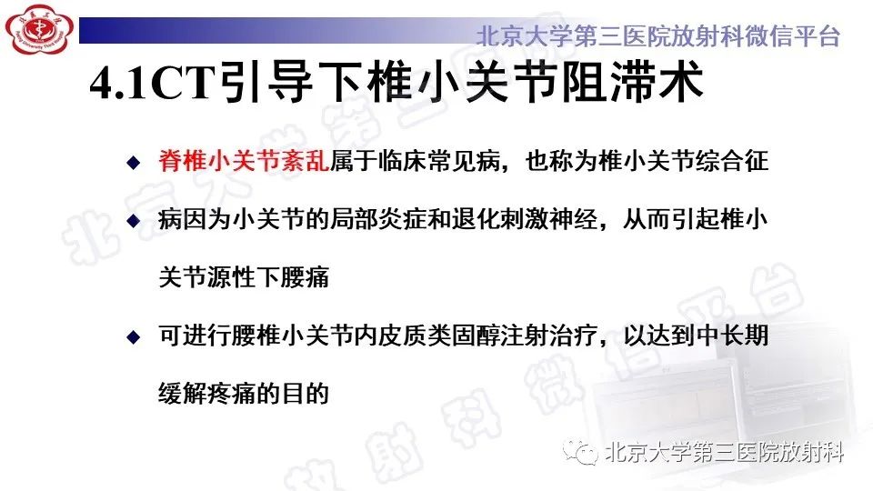 【PPT】CT引导下介入技术在脊柱退行性疾病诊疗中的应用-27