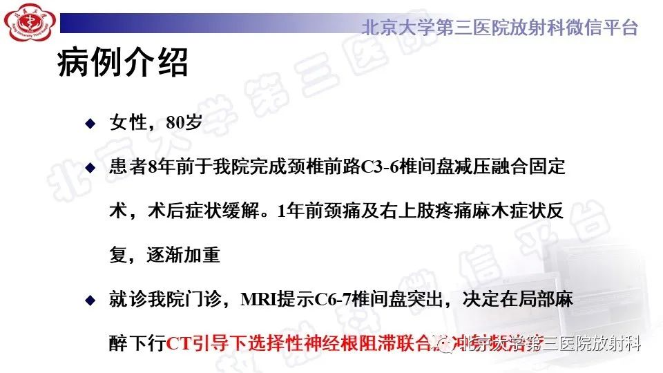 【PPT】CT引导下介入技术在脊柱退行性疾病诊疗中的应用-3
