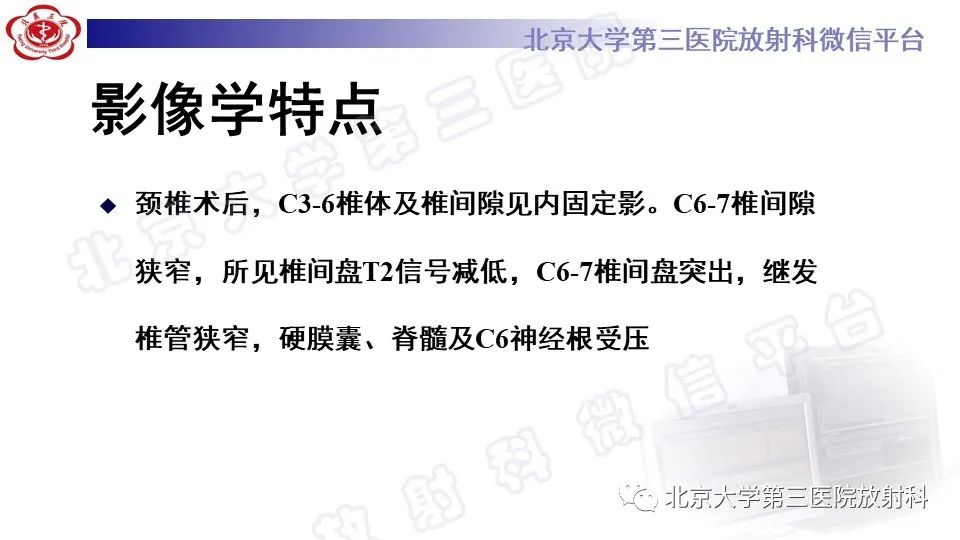 【PPT】CT引导下介入技术在脊柱退行性疾病诊疗中的应用-5