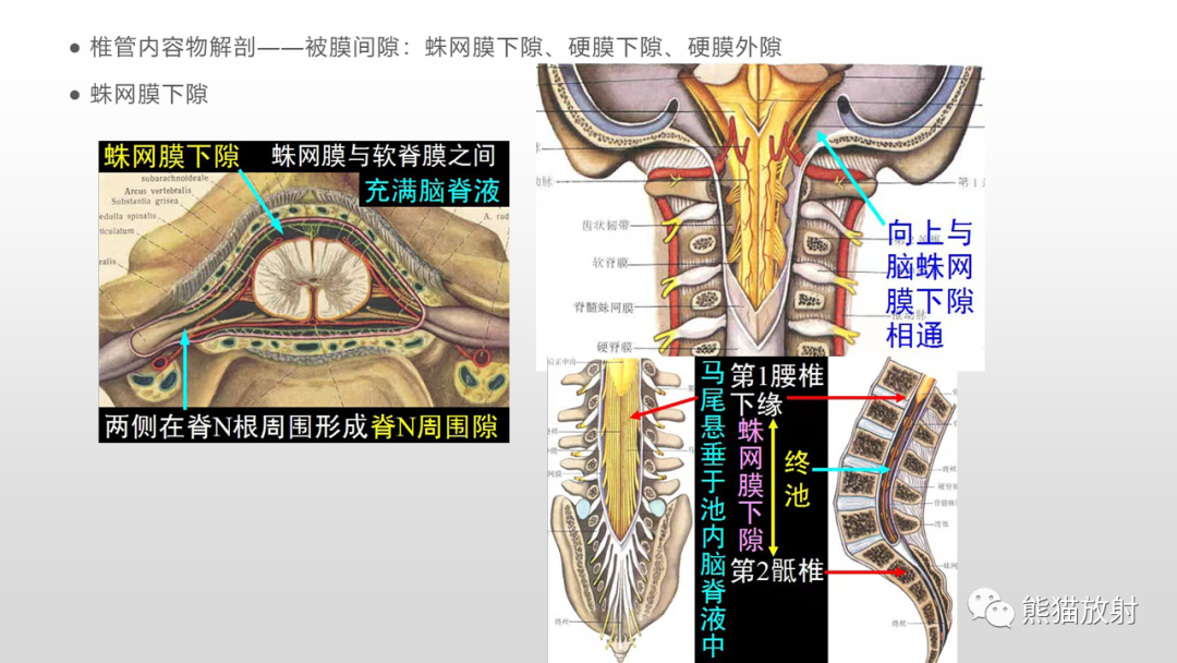 【病例】脊膜瘤2例MR影像-14