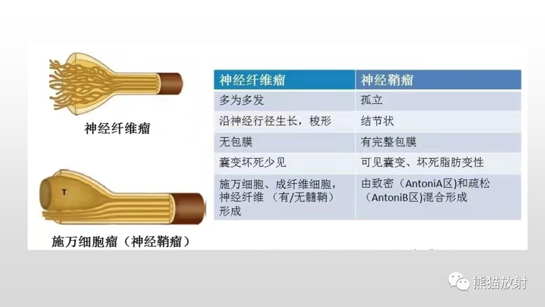 【病例】脊膜瘤2例MR影像-28