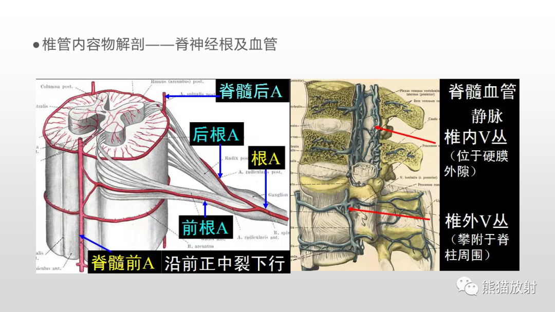 【病例】脊膜瘤2例MR影像-18