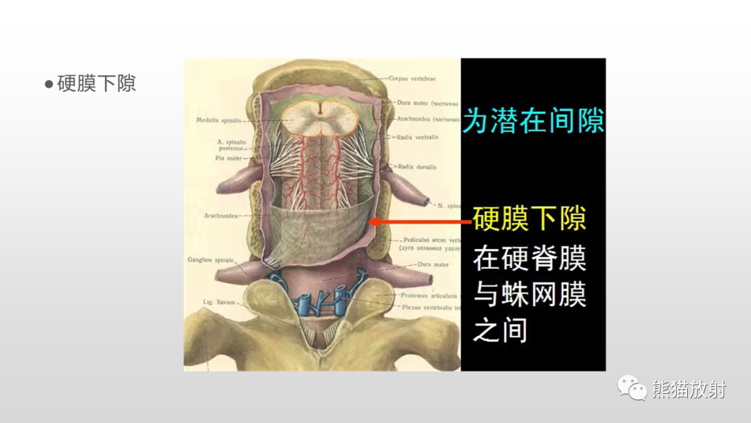 【病例】脊膜瘤2例MR影像-15
