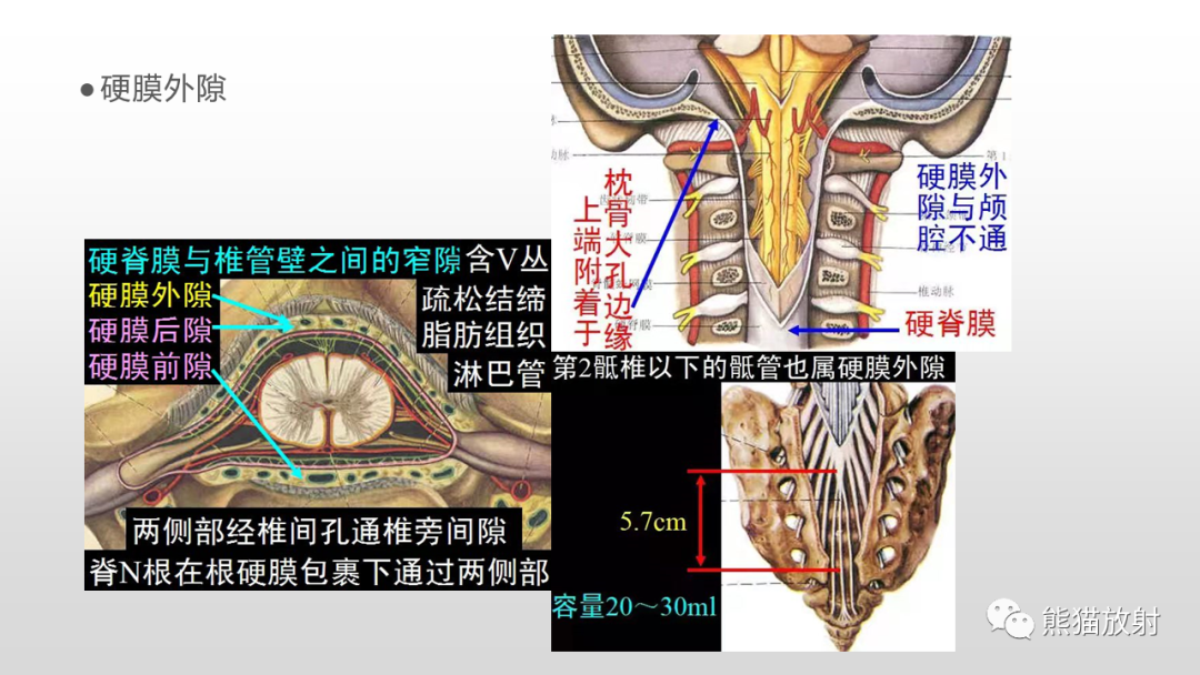 【病例】脊膜瘤2例MR影像-16