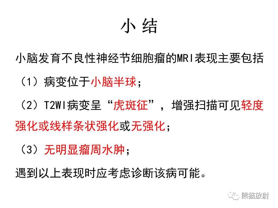 【PPT】小脑发育不良性神经节细胞瘤 VS 成人型髓母细胞瘤-44