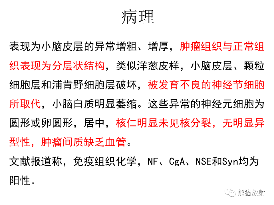 【PPT】小脑发育不良性神经节细胞瘤 VS 成人型髓母细胞瘤-30