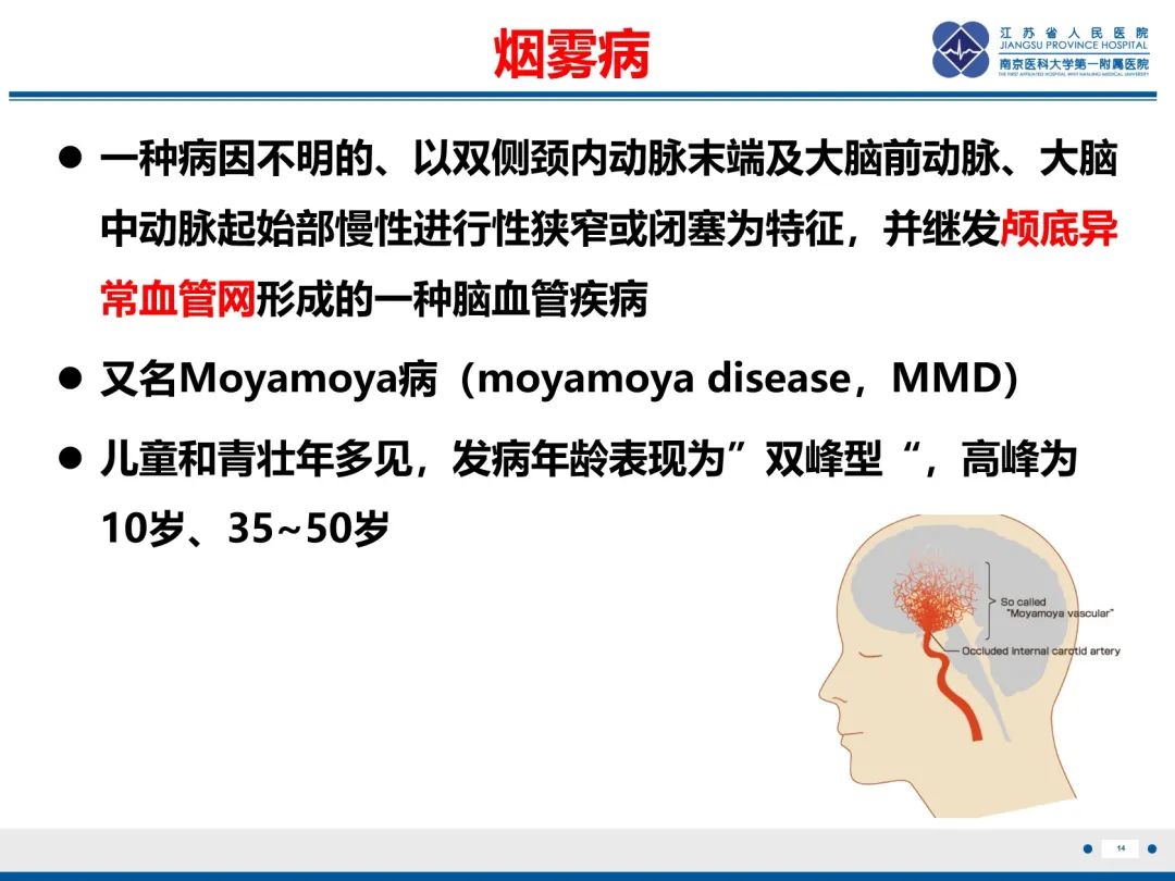 【PPT】烟雾病和烟雾综合征血管重建术后影像评估-15