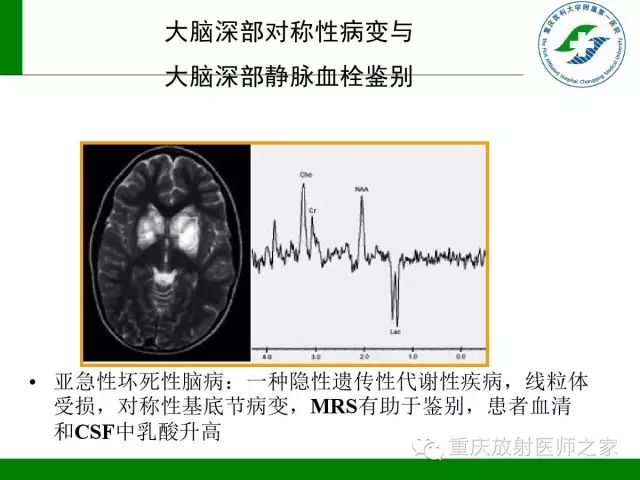 【PPT】脑静脉解剖及相关疾病影像学诊断-63