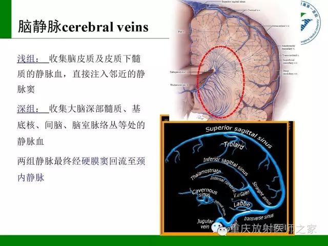 【PPT】脑静脉解剖及相关疾病影像学诊断-4