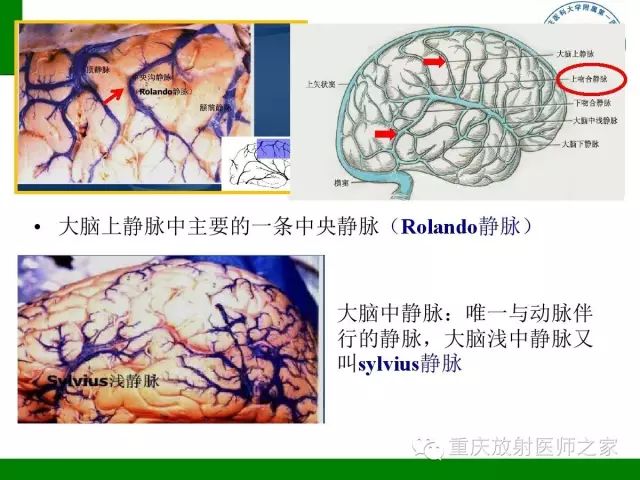 【PPT】脑静脉解剖及相关疾病影像学诊断-7