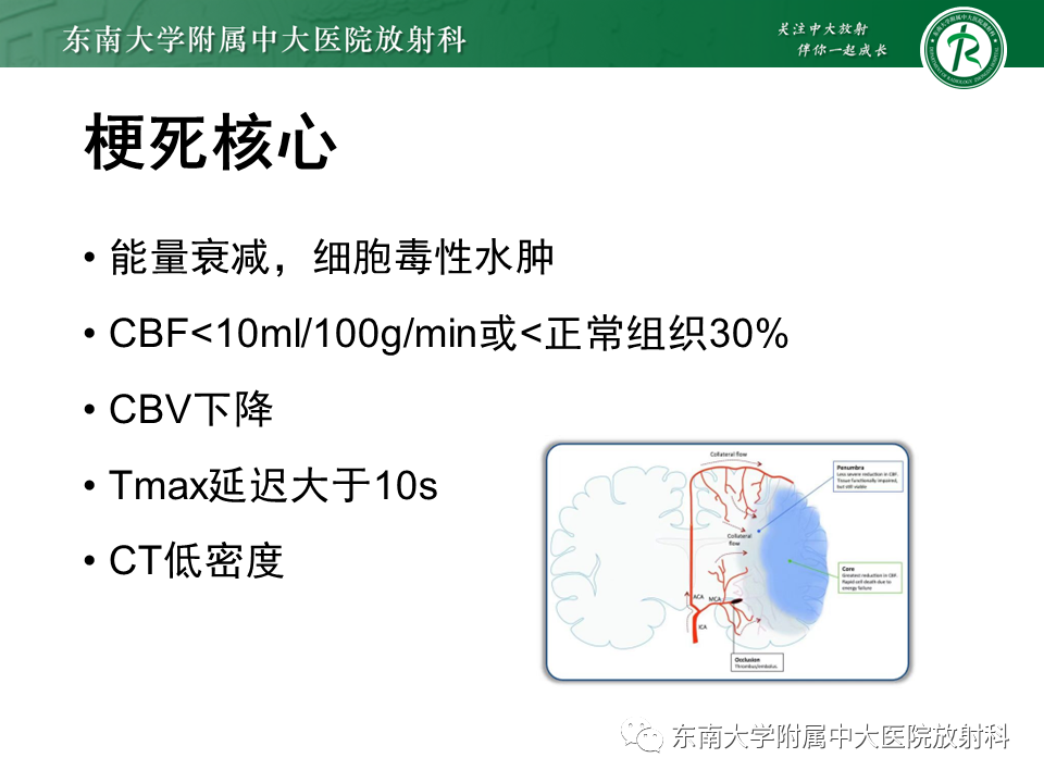 【PPT】急性缺血性脑卒中的多模态CT评估-37 【PPT】急性缺血性脑卒中的多模态CT评估-37