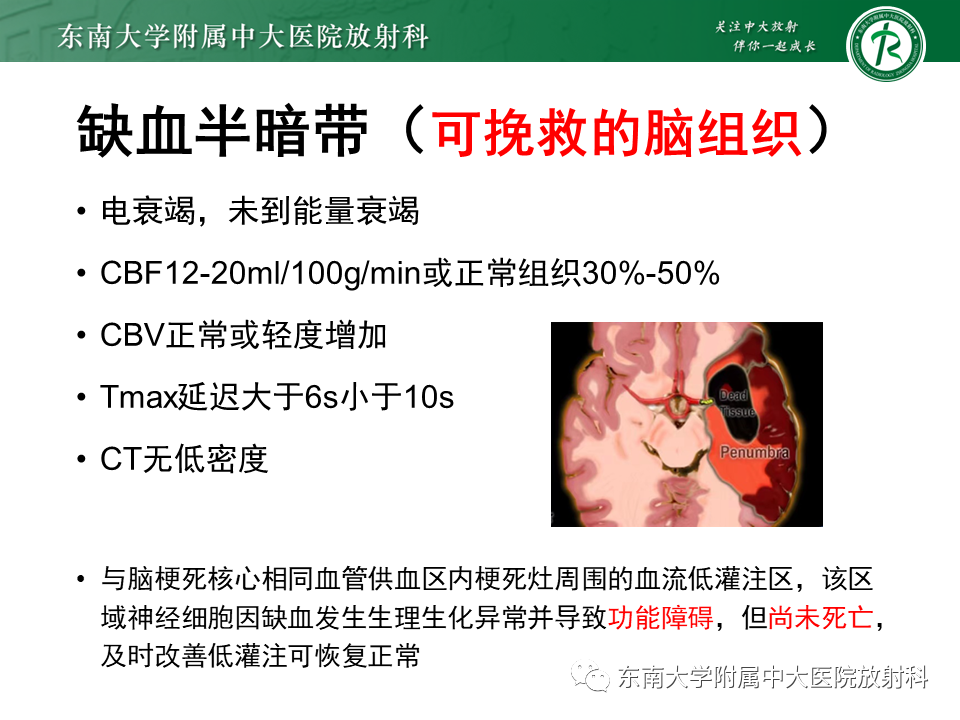 【PPT】急性缺血性脑卒中的多模态CT评估-38
