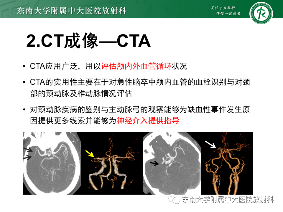 【PPT】急性缺血性脑卒中的多模态CT评估-30