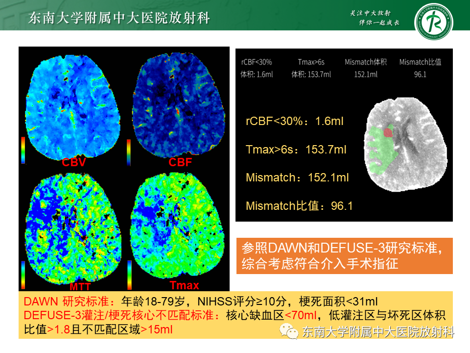 【PPT】急性缺血性脑卒中的多模态CT评估-52