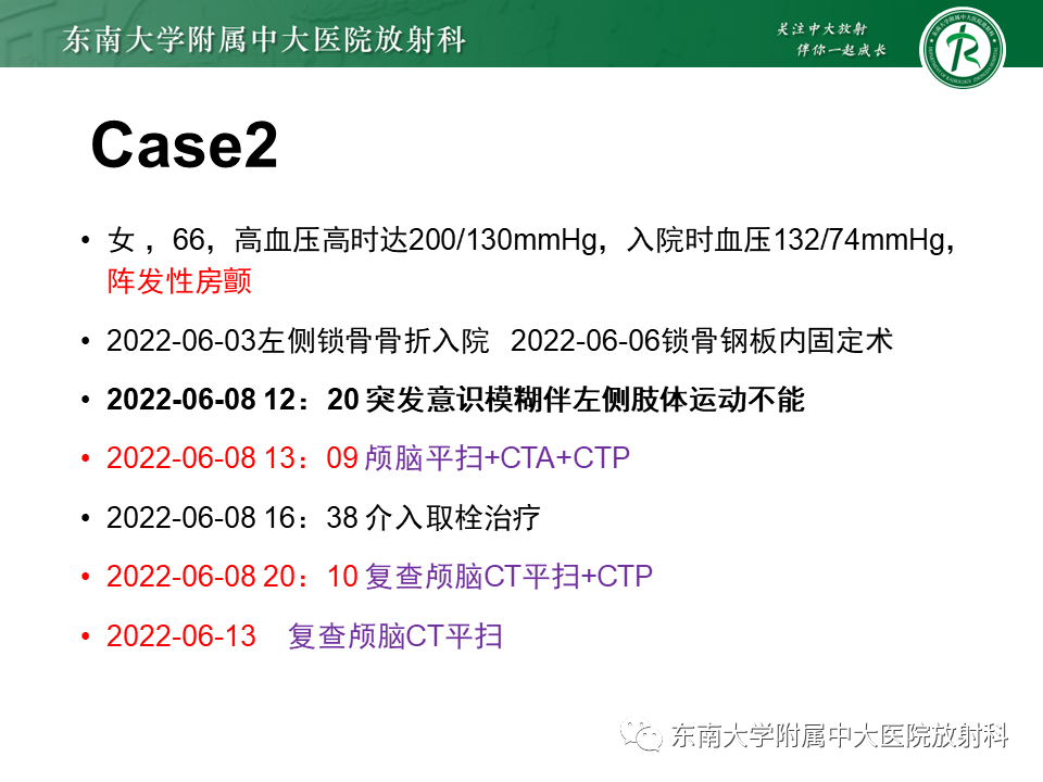 【PPT】急性缺血性脑卒中的多模态CT评估-53 【PPT】急性缺血性脑卒中的多模态CT评估-53